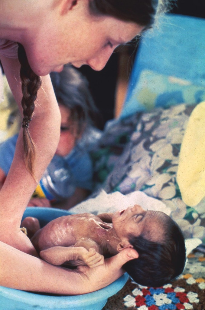 Lisa Wartinger, 1977, Guatemala, San Andrés Itzapa, Medical Relief, Rural Health